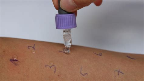 false negative allergy test results